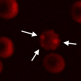 Images of an echinocyte illuminated with a pump pump wavelength of 921 nm