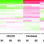 Variations importantes du niveau de pseudouridylations des ARN ribosomiques dans différents types cellulaires