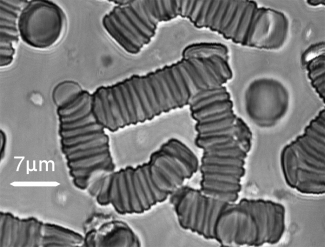 Image of typical rouleaux structures for RBCs under no shear stresses and suspended in autologous plasma