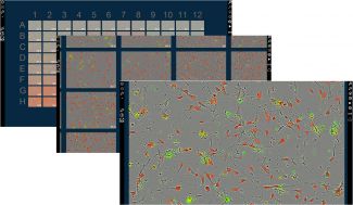 IncuCyte Analysis Software