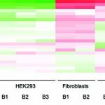 Variability of pseudouridine levels in different human cell lines